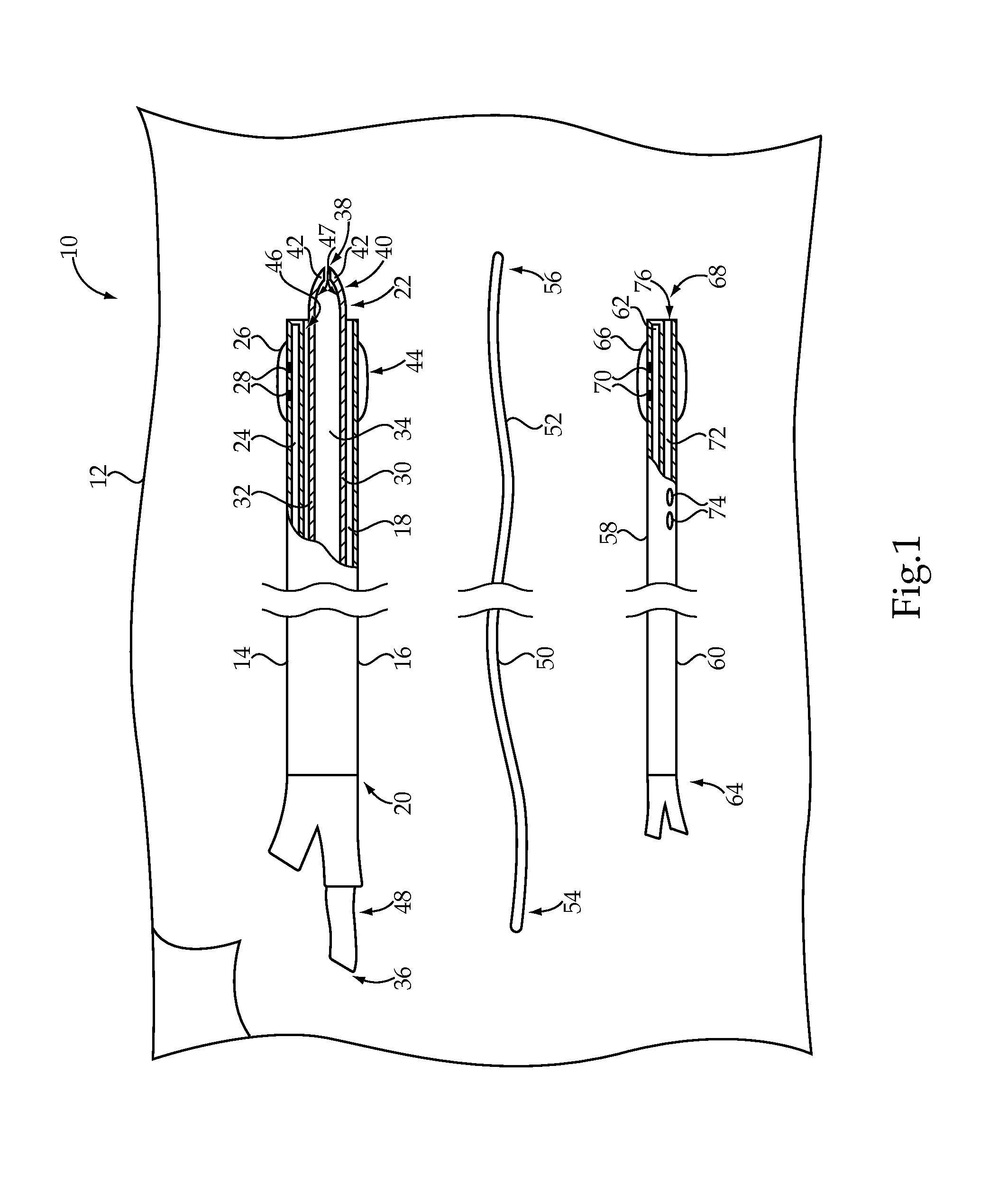 Clot removal system and method