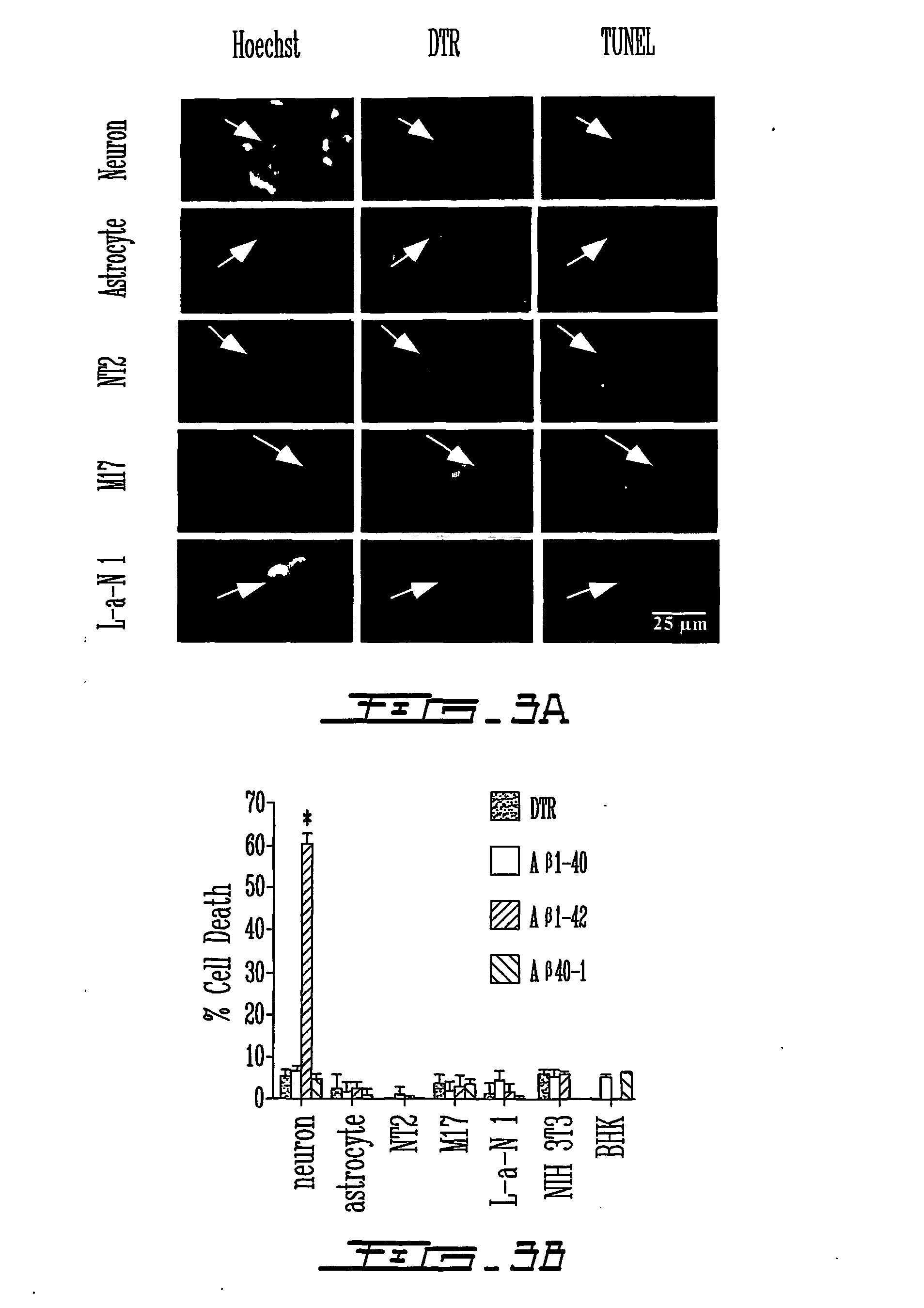 Selective inhibition of intracellular amyloid-beta neurotoxicity in human neurons