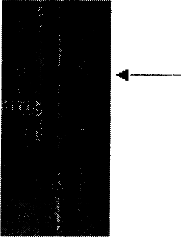 Gene transfer method for promoting insect resistance of soybean