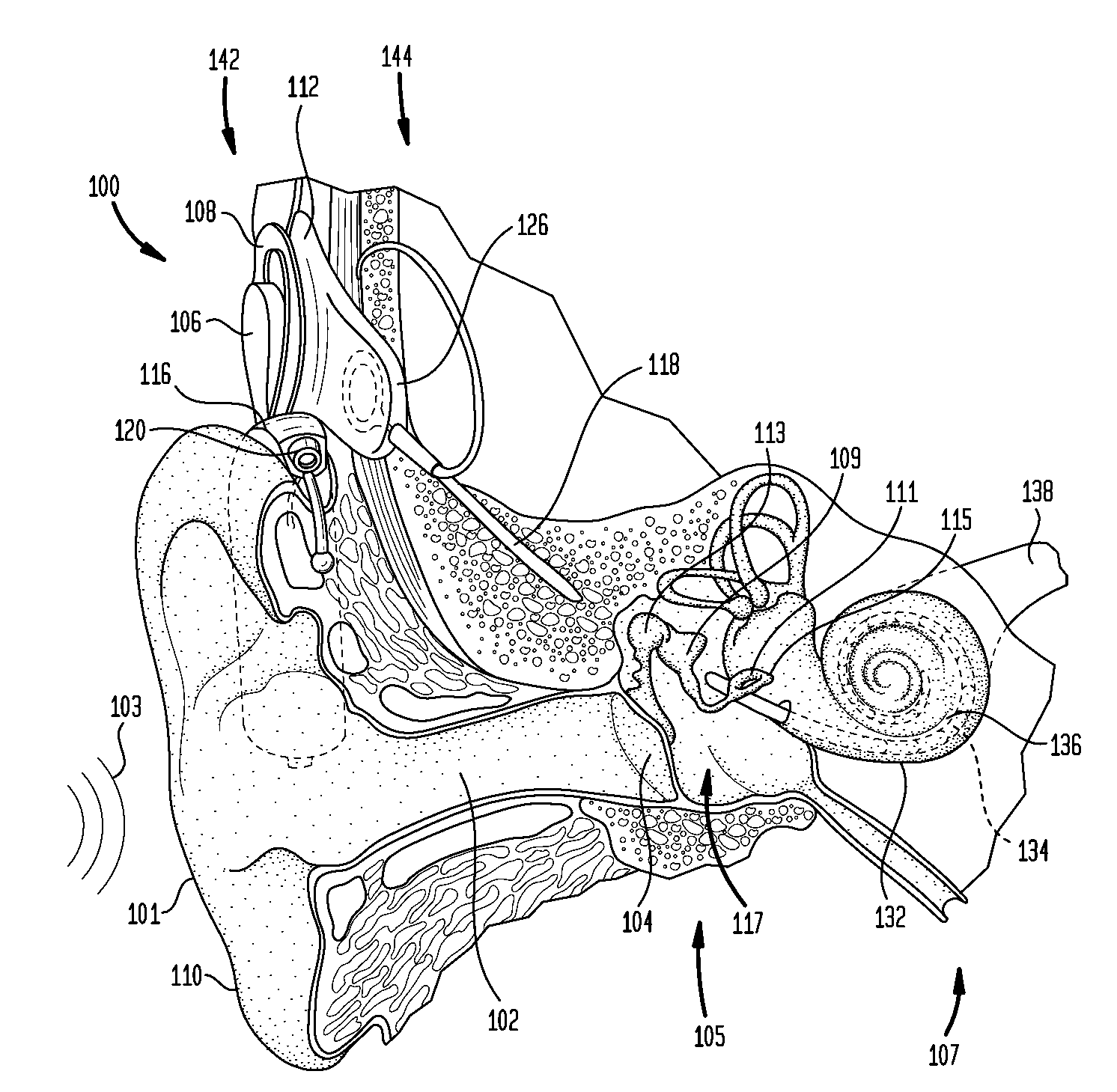 Recipient-controlled fitting of a hearing prosthesis