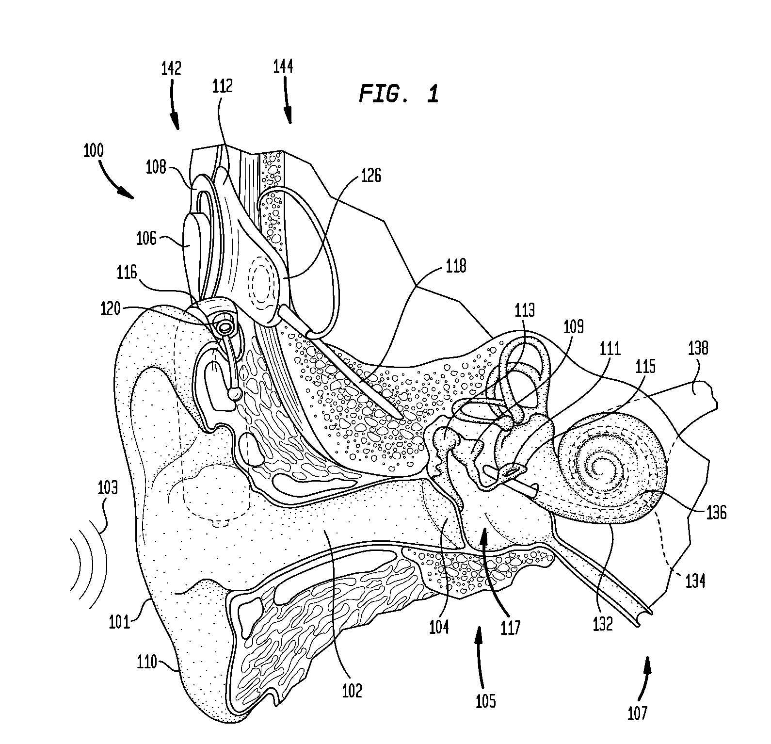 Recipient-controlled fitting of a hearing prosthesis