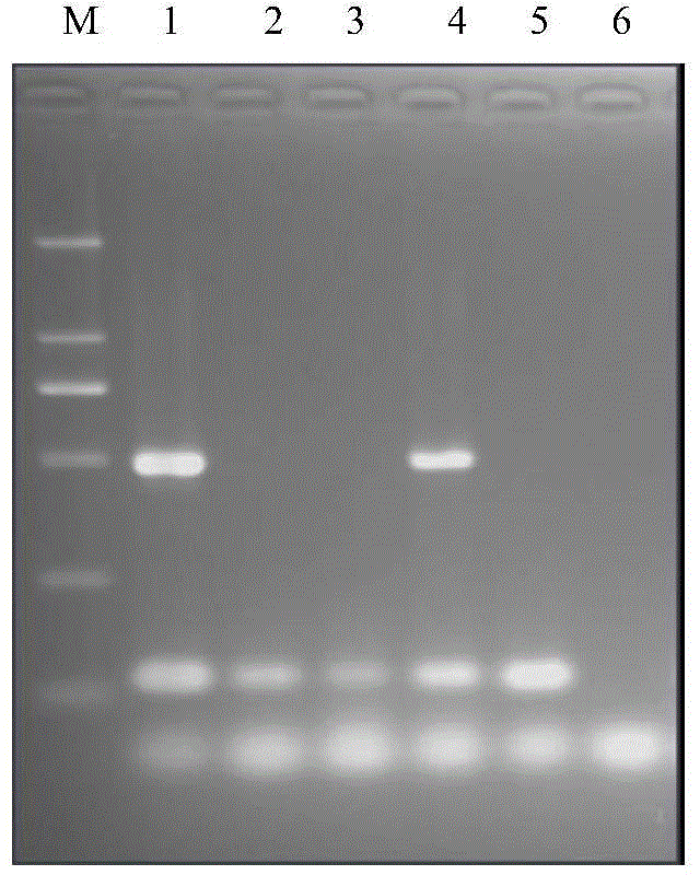 LAMP (Loop-Mediated Isothermal Amplification) rapid detection method and application of glyphosate-resist transgenic soybean