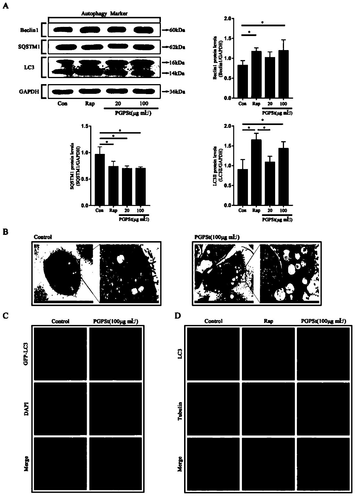 Application of platycodon grandiflorum polysaccharide in antagonizing fumonisin B1-induced apoptosis through autophagy