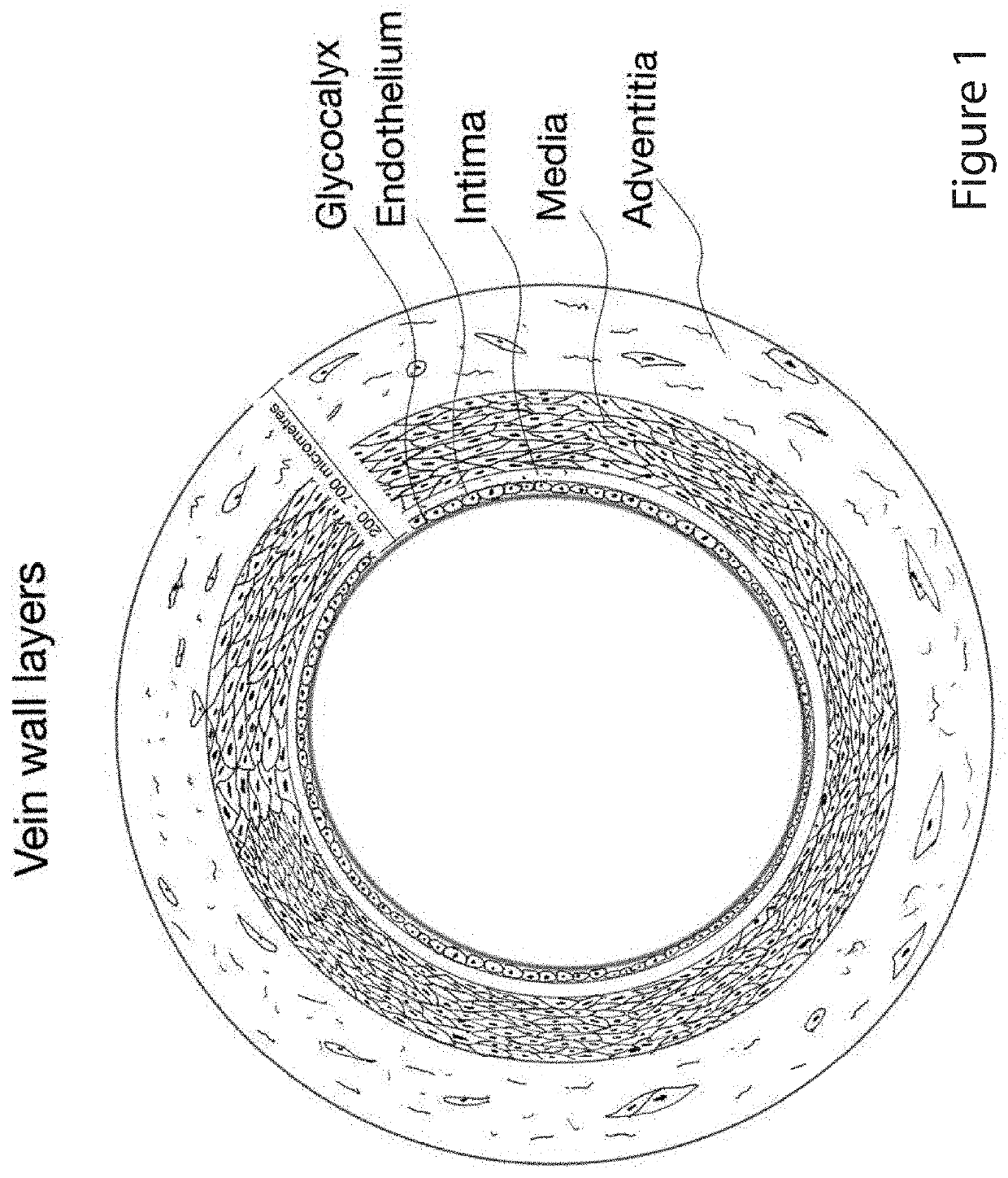 Device for denuding a body lumen