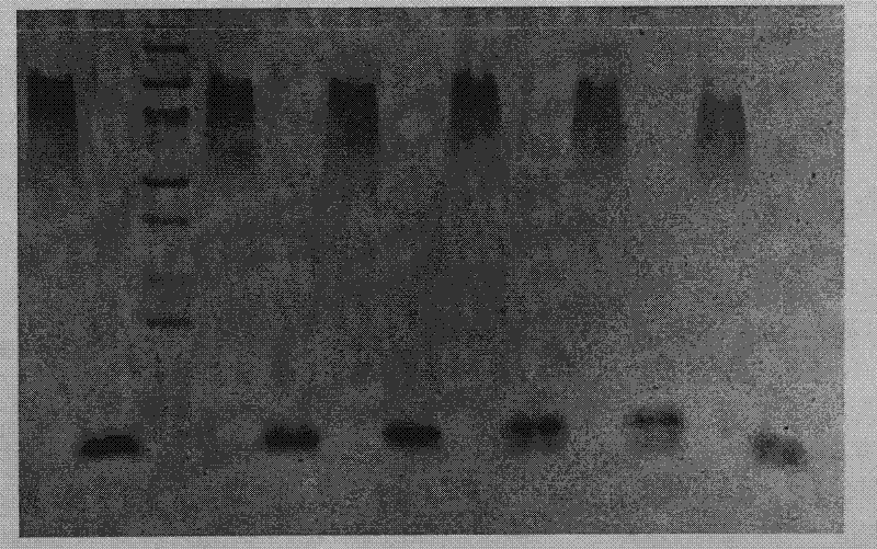 Epitope delivery system with Escherichia coli heat labile enterotoxin B subunits serving as carriers