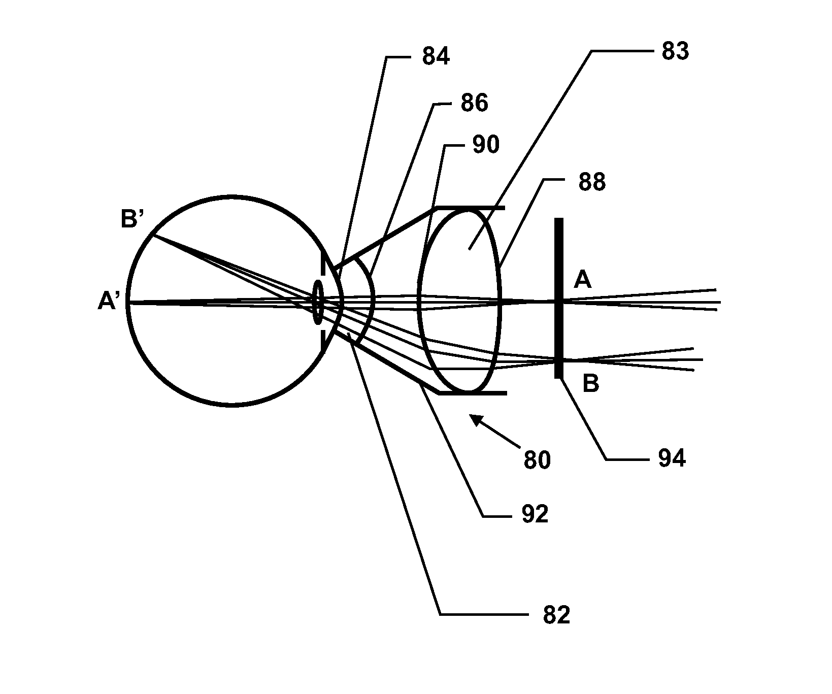 Molded ophthalmic lens