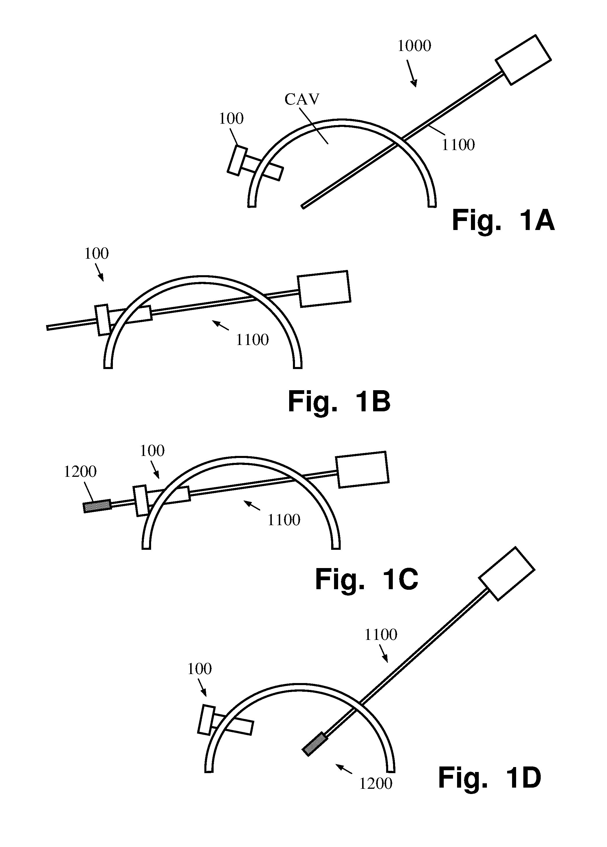 Laparoscope system