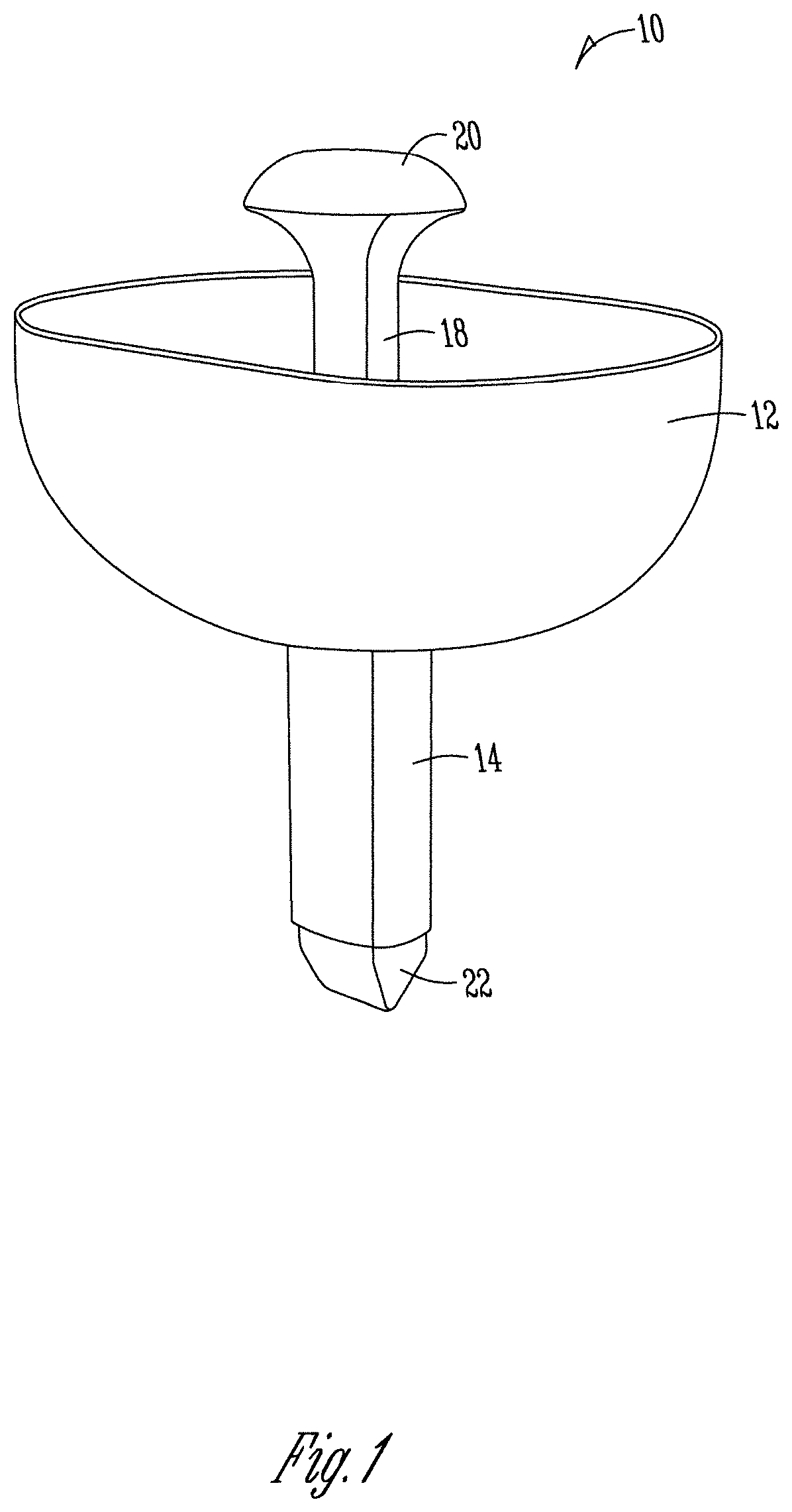 Thoracoscopic irrigation cannula