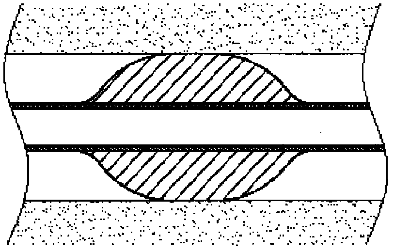 Tracheal catheter with corrugated air sac