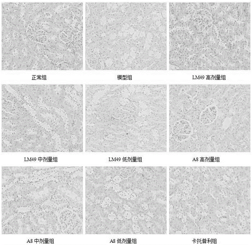 Application of two halophenol compounds in preparation of medicines of resisting type II diabetic nephropathy