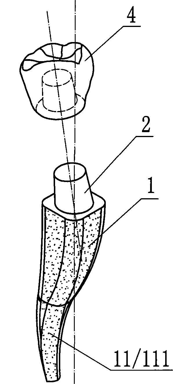 Asymmetric dental implant