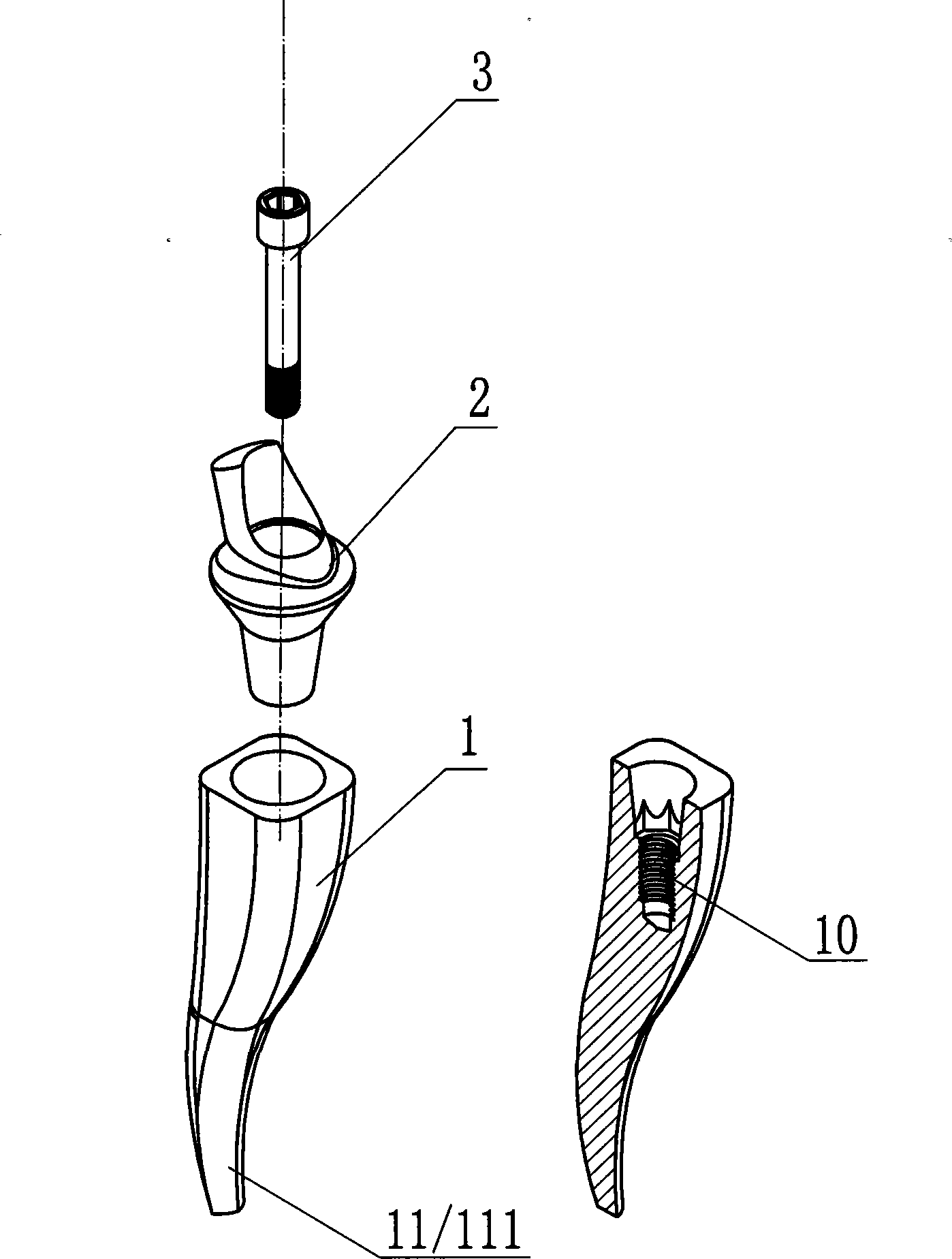 Asymmetric dental implant