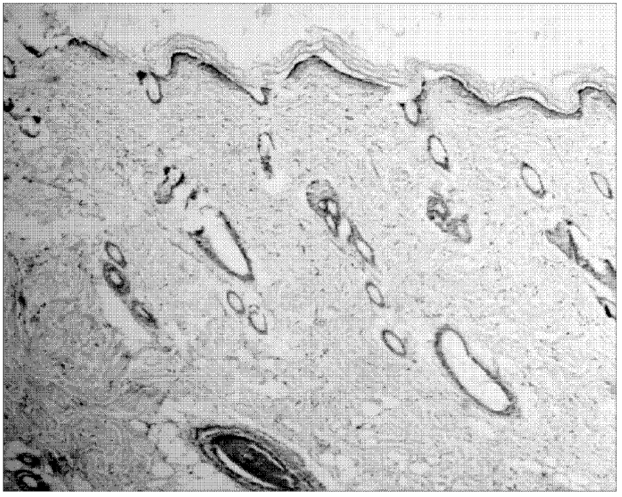 Periplaneta Americana L. and gel externally applied medicinal composition and preparation method and use thereof in preparation of externally applied medicines for treating scalding