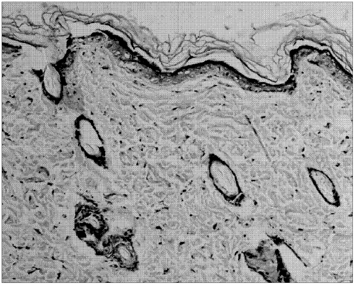 Periplaneta Americana L. and gel externally applied medicinal composition and preparation method and use thereof in preparation of externally applied medicines for treating scalding