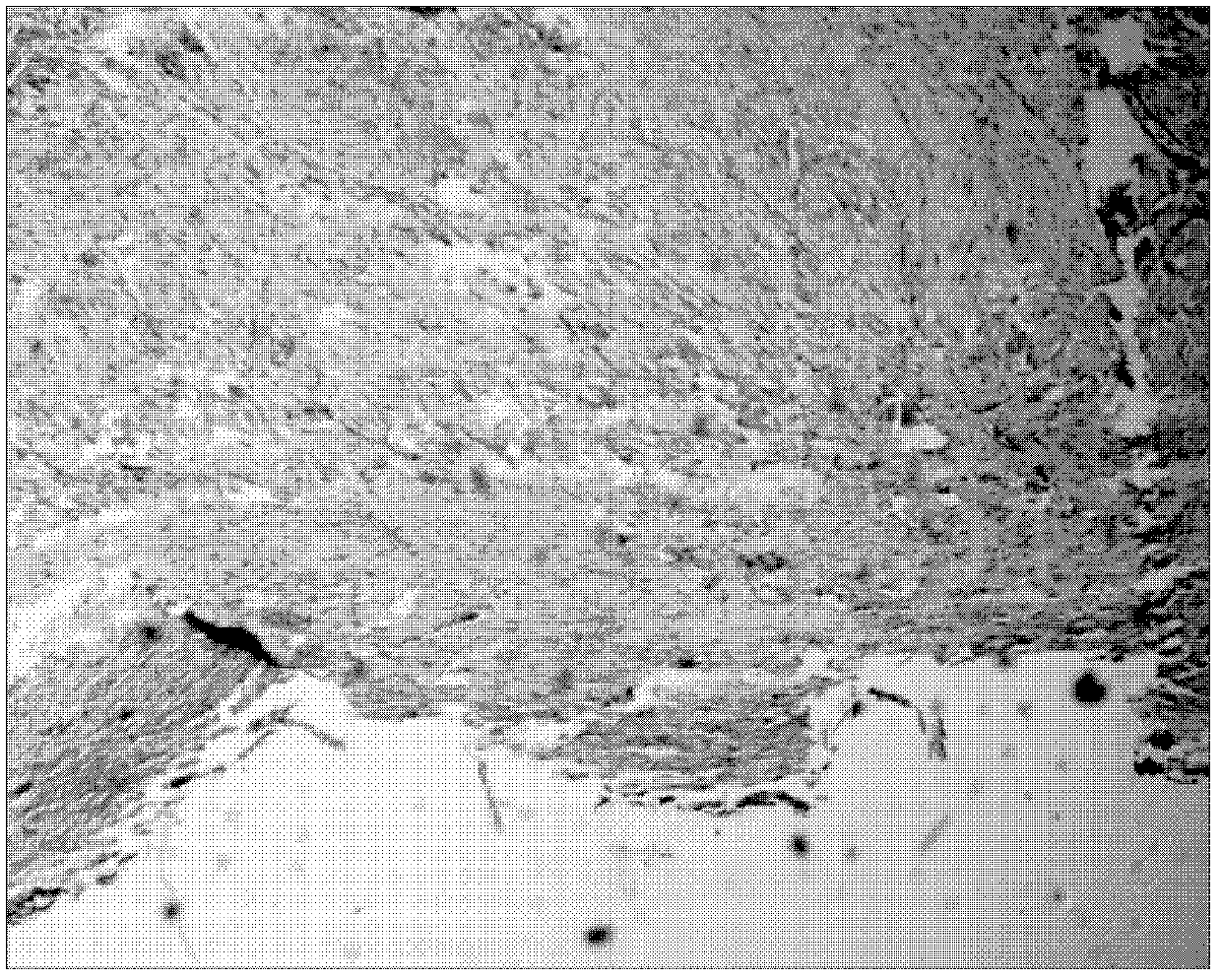 Periplaneta Americana L. and gel externally applied medicinal composition and preparation method and use thereof in preparation of externally applied medicines for treating scalding