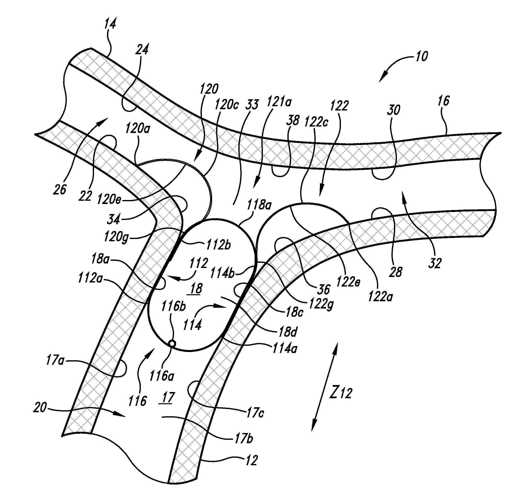 Vascular anchoring system and method