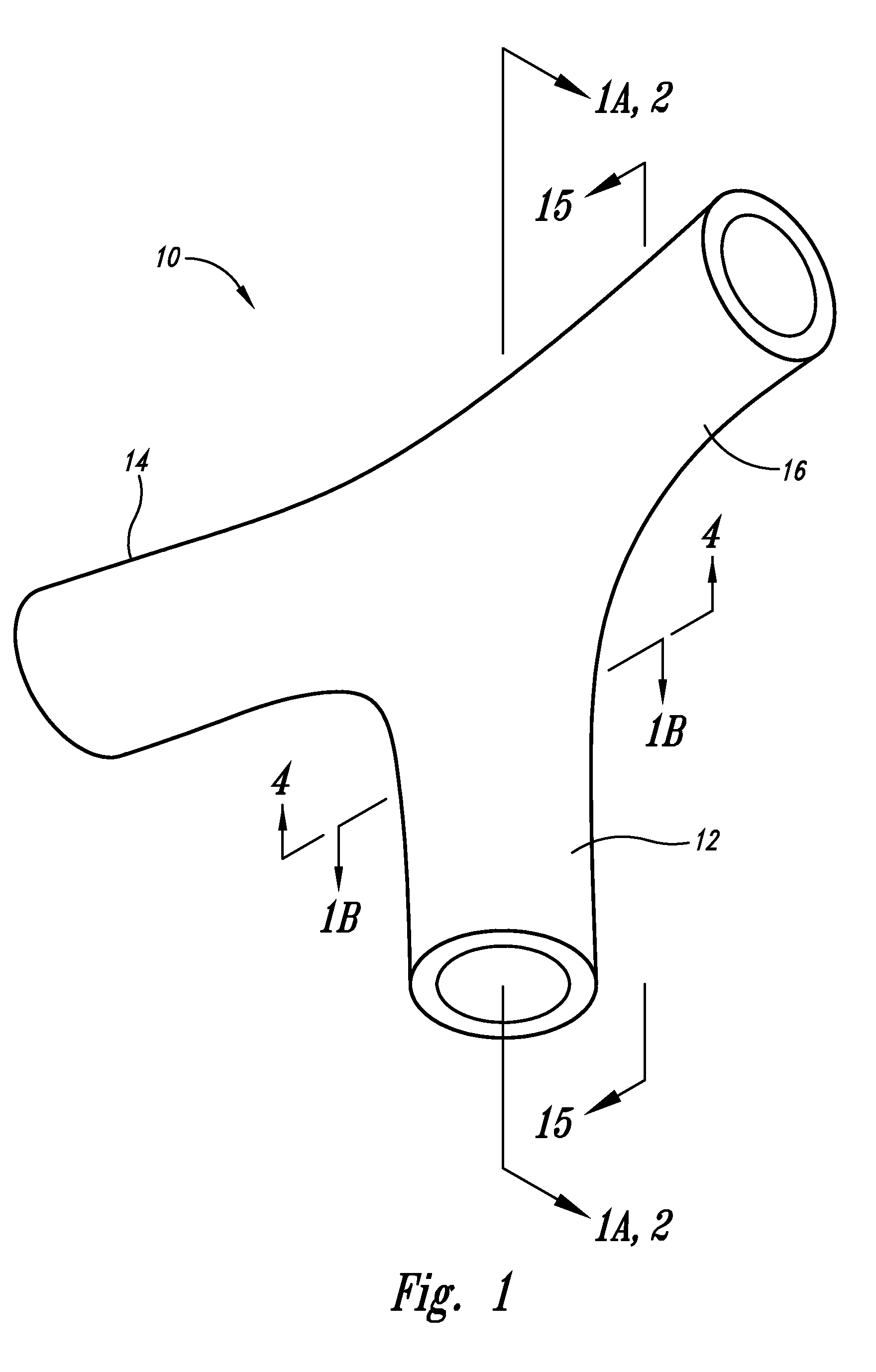 Vascular anchoring system and method