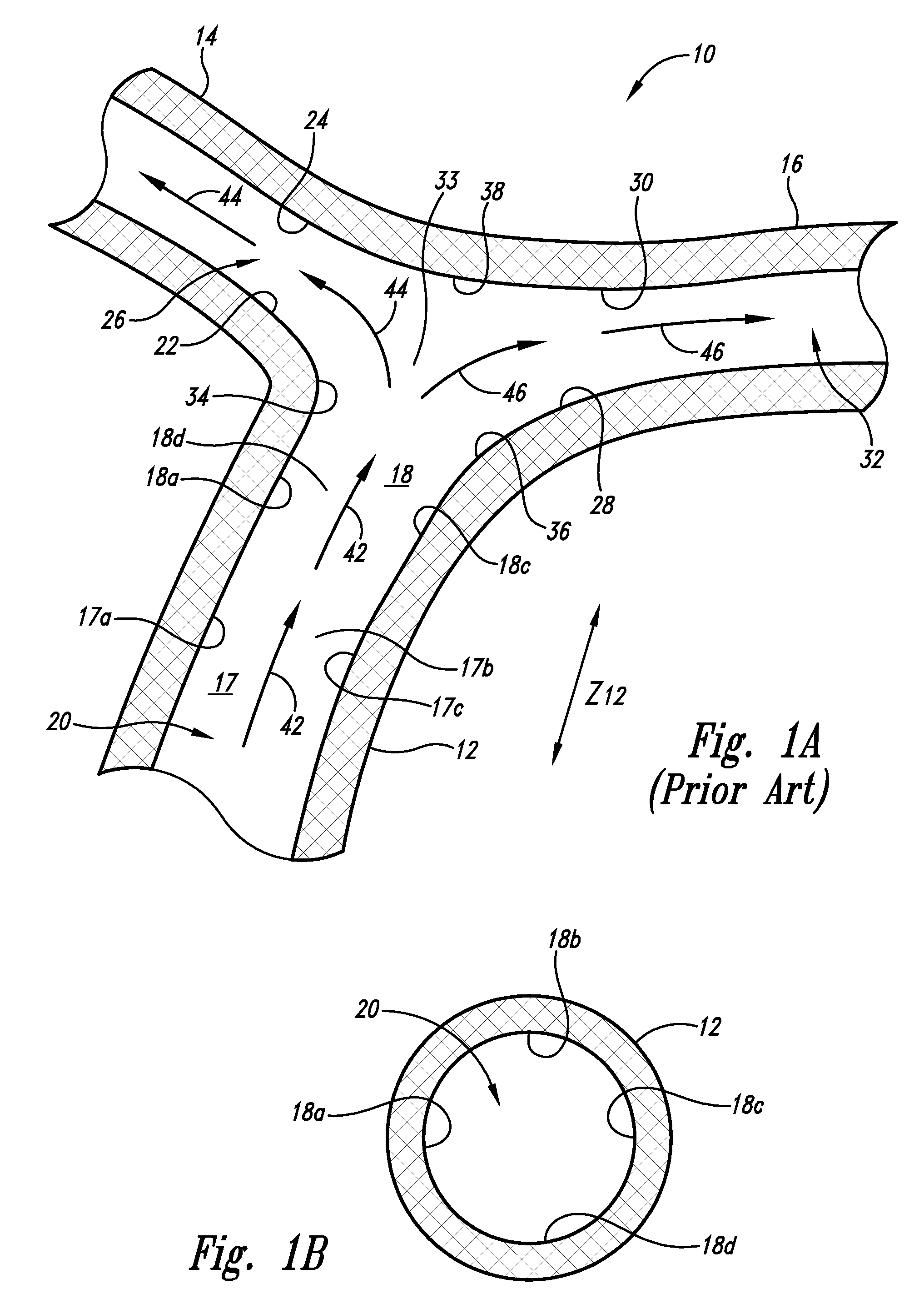 Vascular anchoring system and method