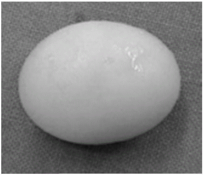 Cholelithiasis related blood plasma metabolism micro-molecular marker and application thereof