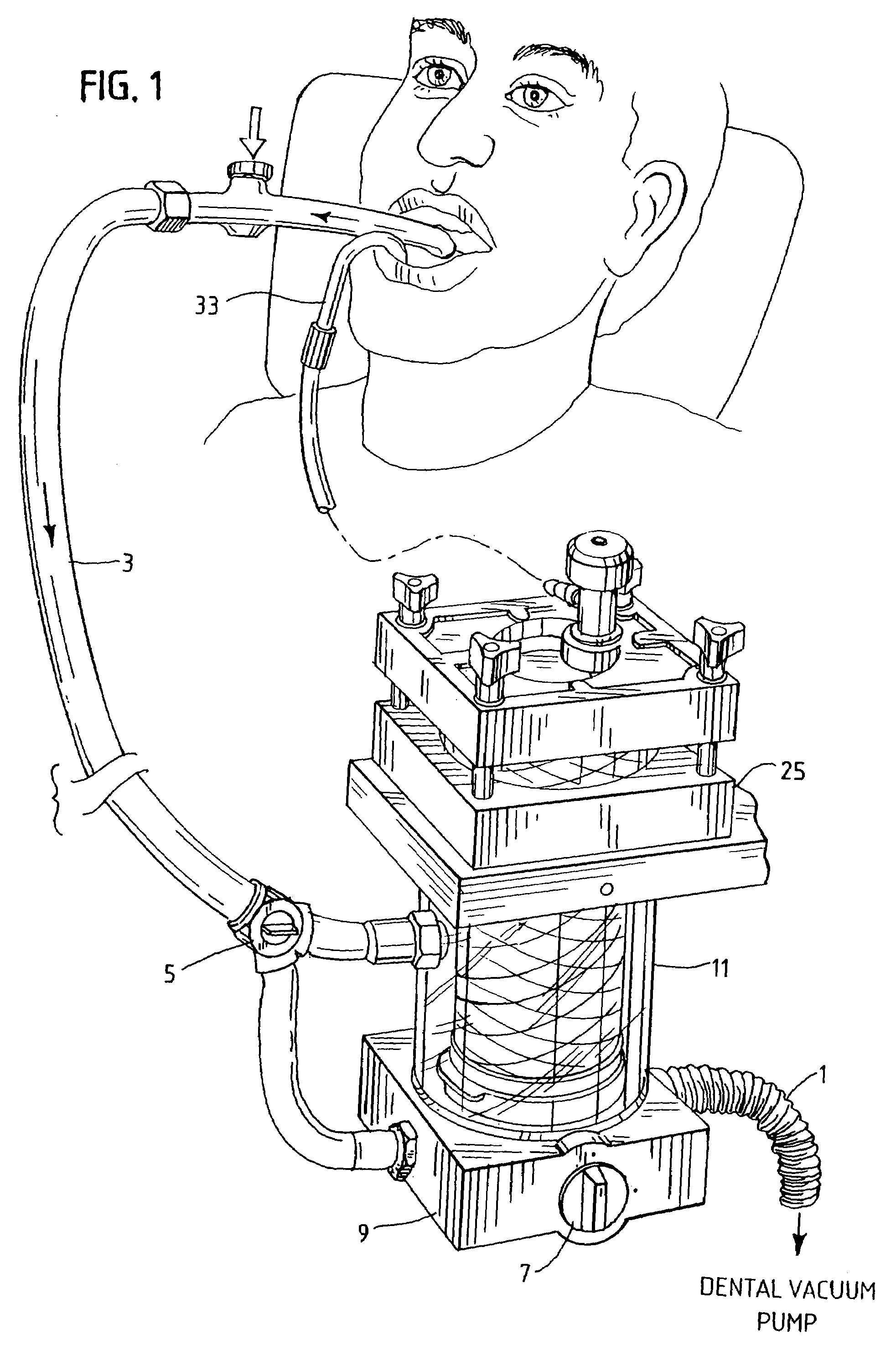 Method and apparatus for removing particulate metals from dental waste water