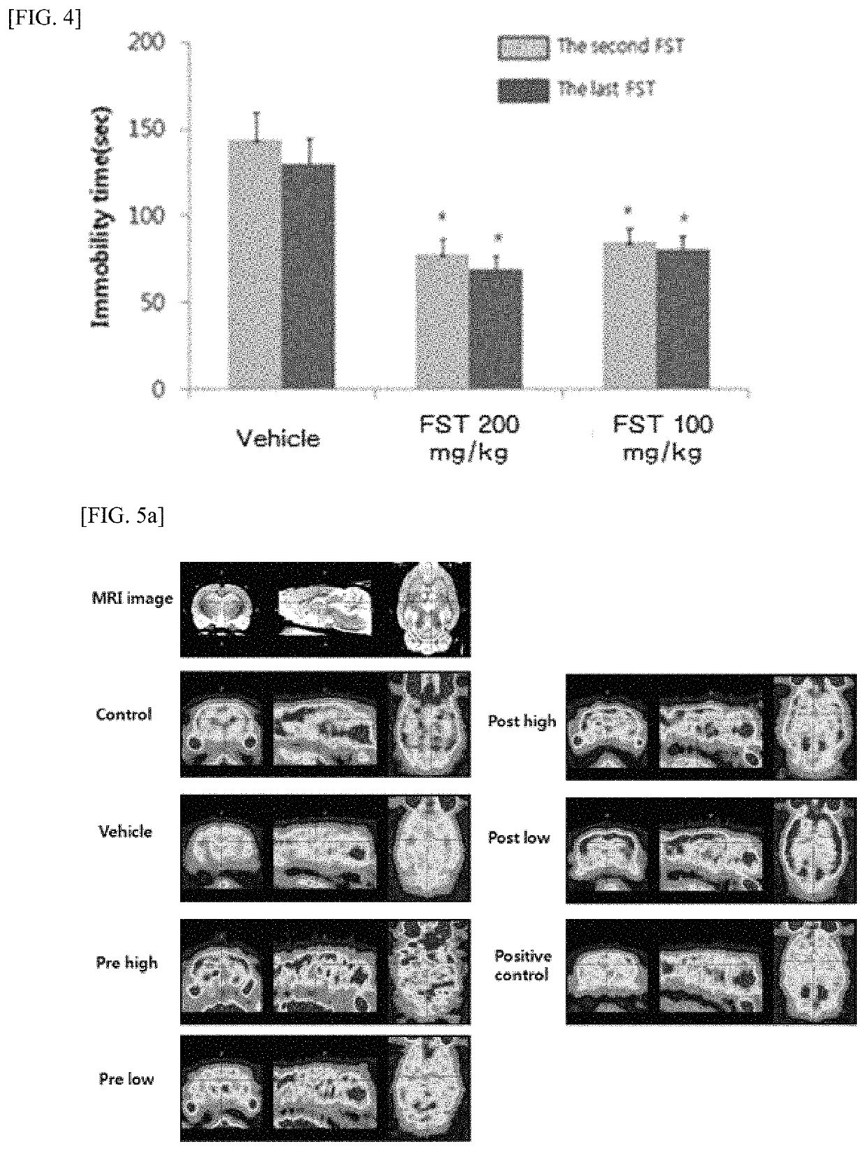 Composition for preventing or treating cranial nerve disease comprising fomes fomentarius extract, fraction thereof, or compound isolated therefrom as active ingredient