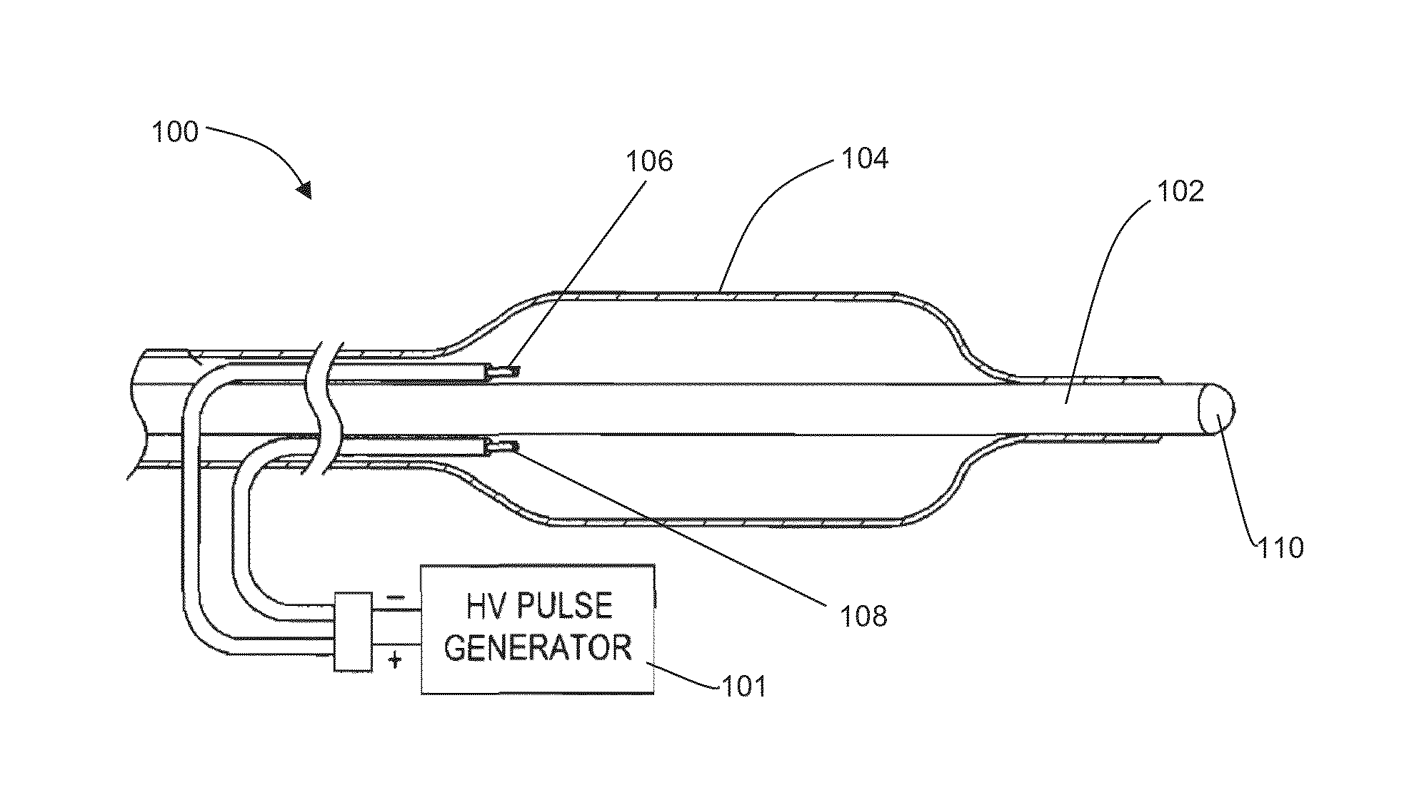 Shockwave nerve therapy system and method