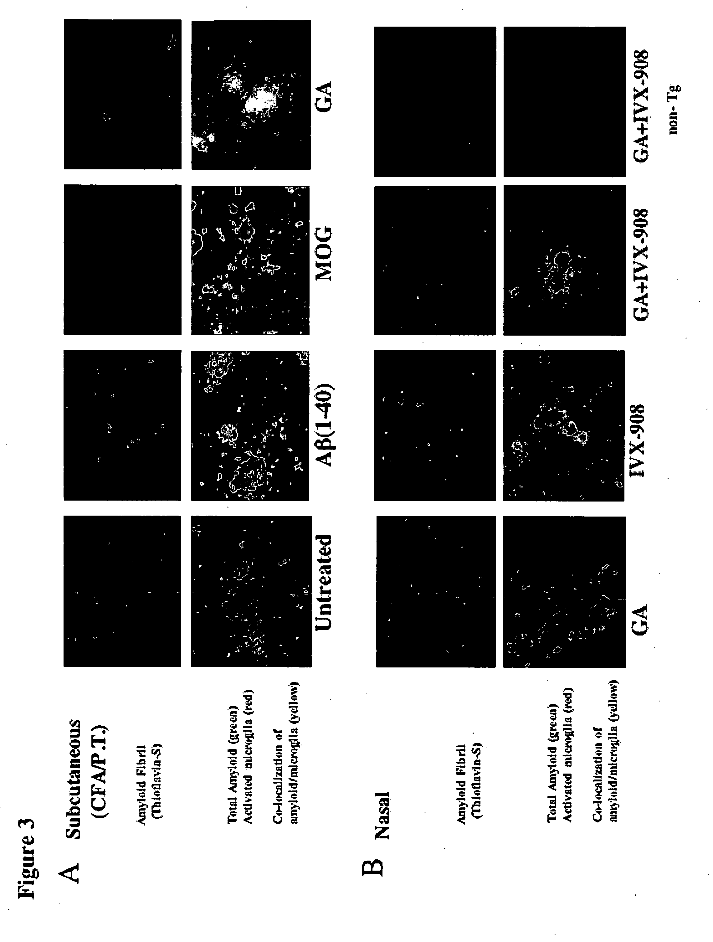 Compositions and methods for treating neurological disorders