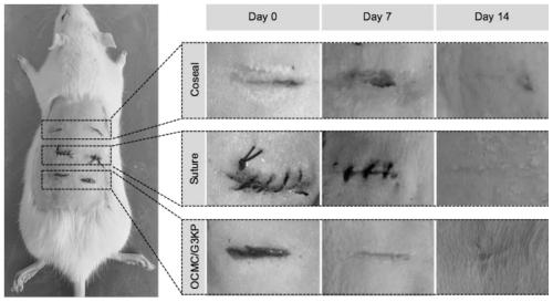 Soft tissue adhesive with antibacterial and hemostatic functions