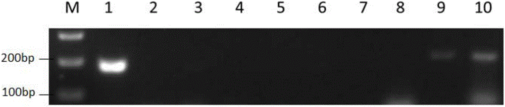 Primer group for detecting renal cancer and detecting method thereof