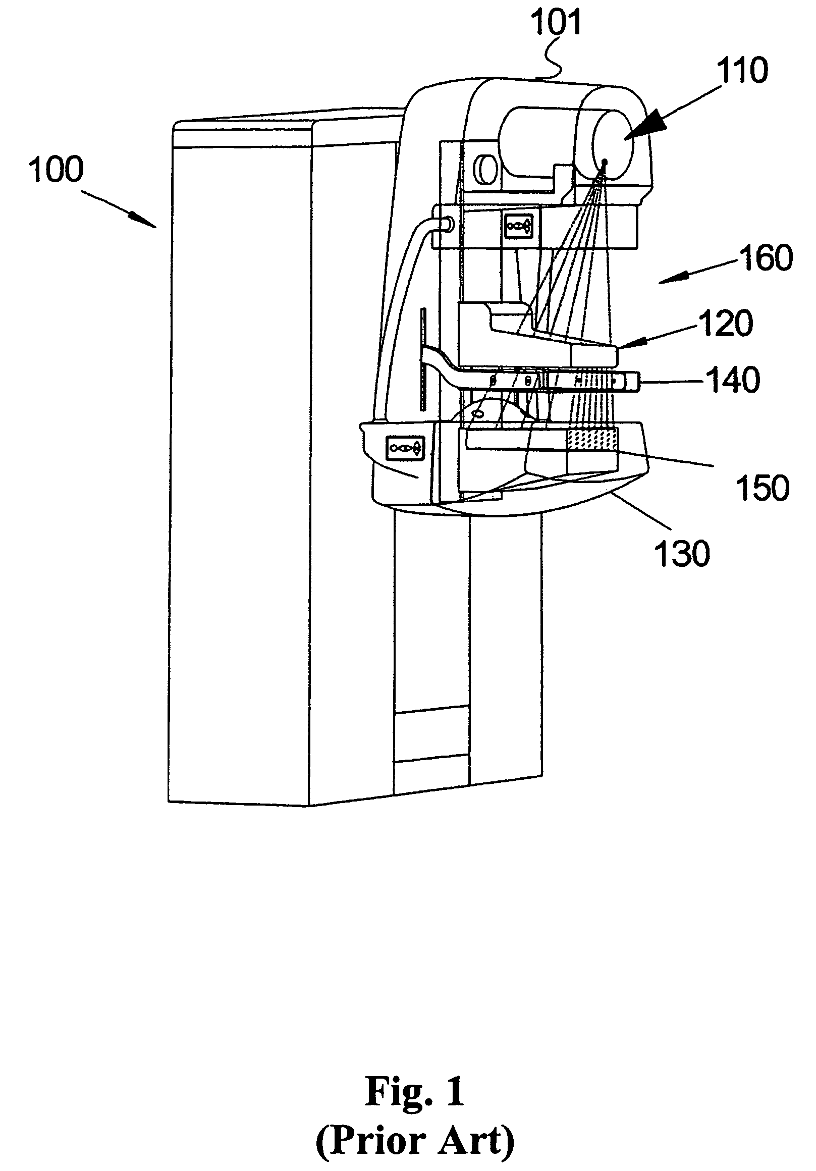 Method and arrangement relating to x-ray imaging