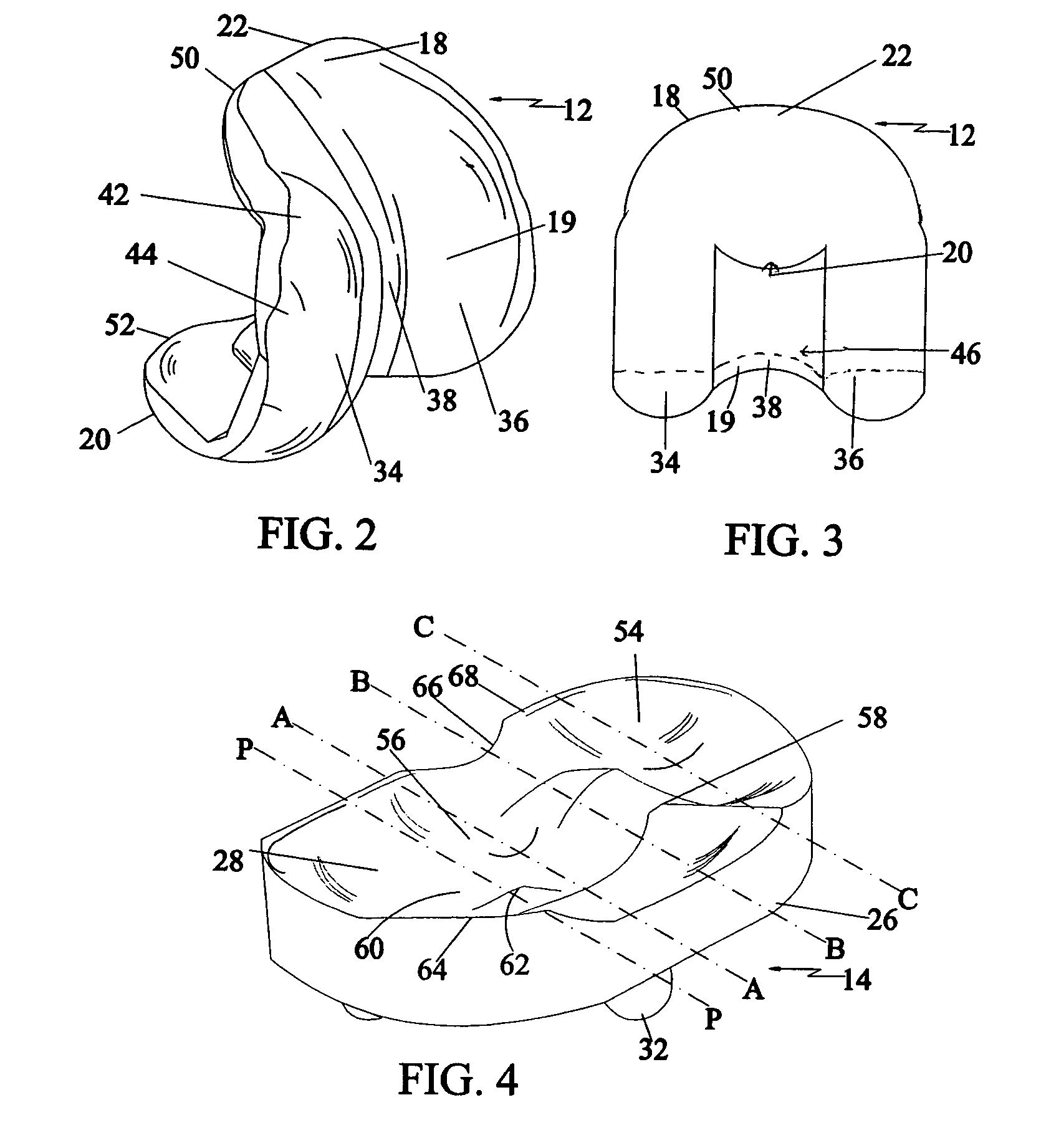 Knee joint with a ramp