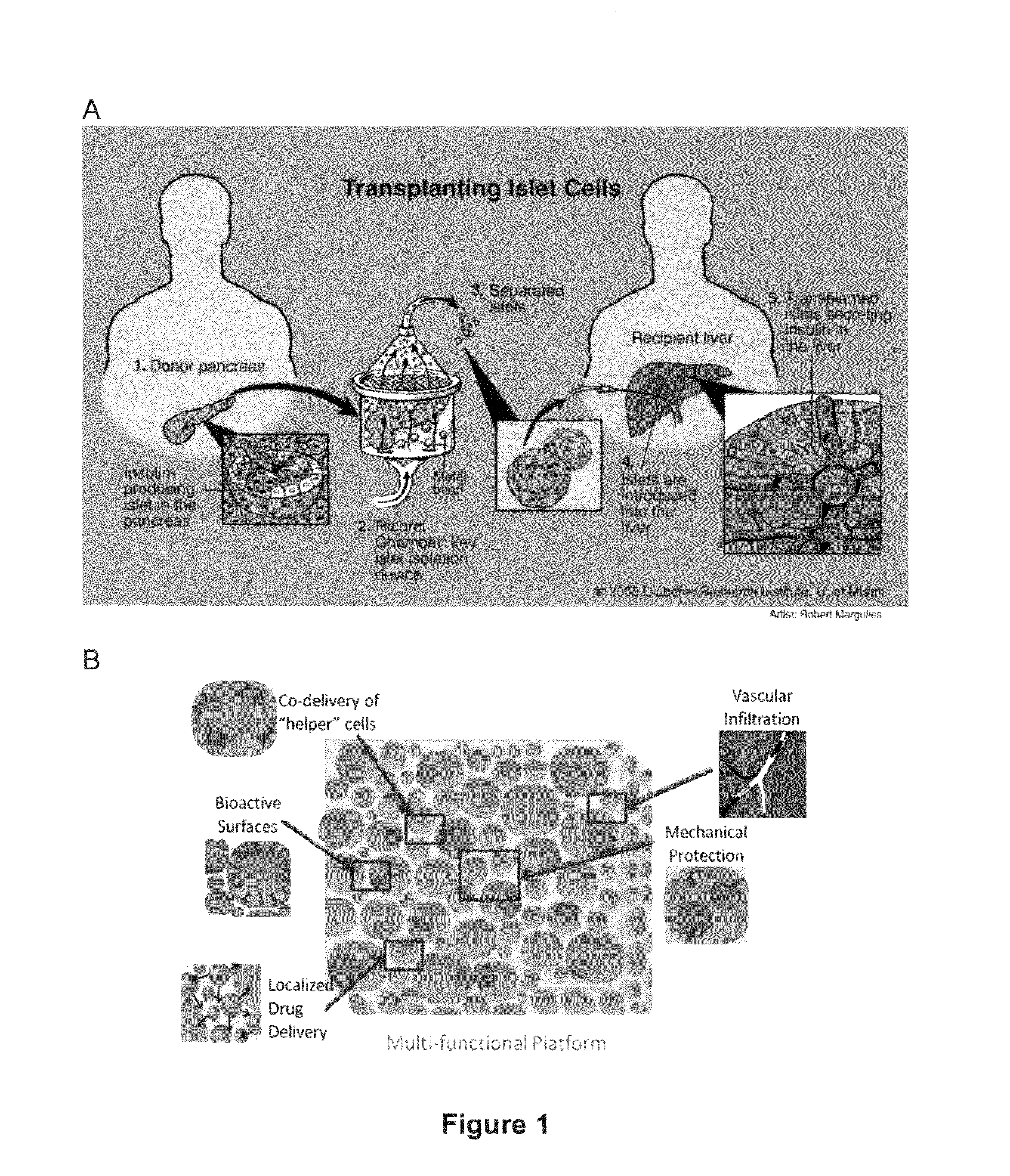 Macroporous bioengineered scaffolds for cell transplantation