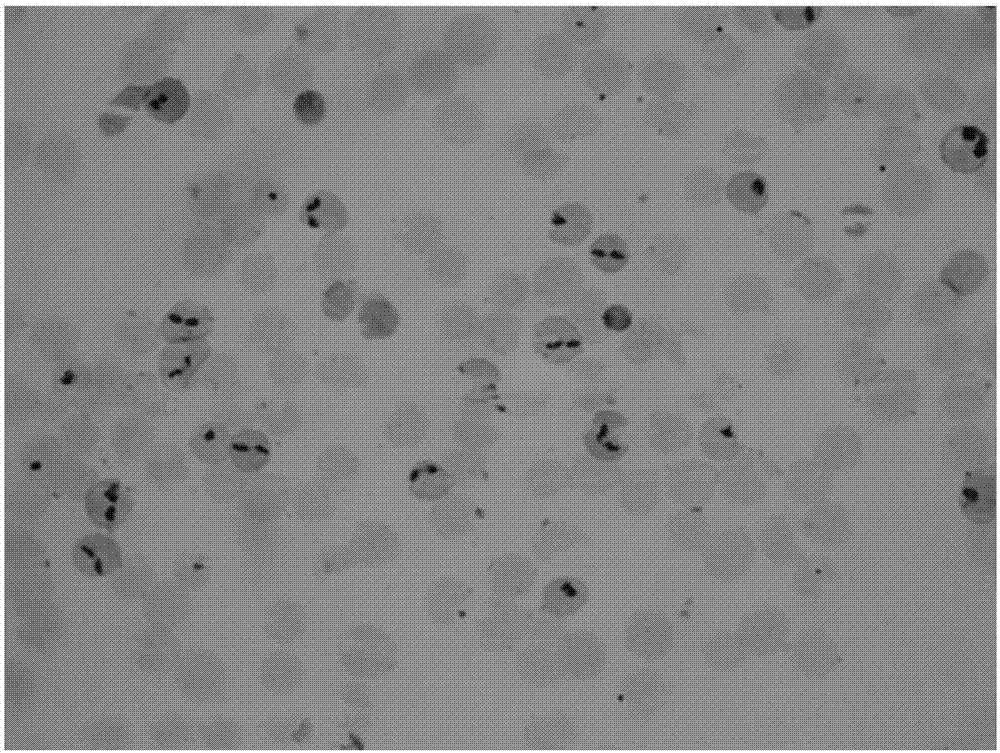 Compound staining solution of piroplasma blood smear and staining method of blood smear