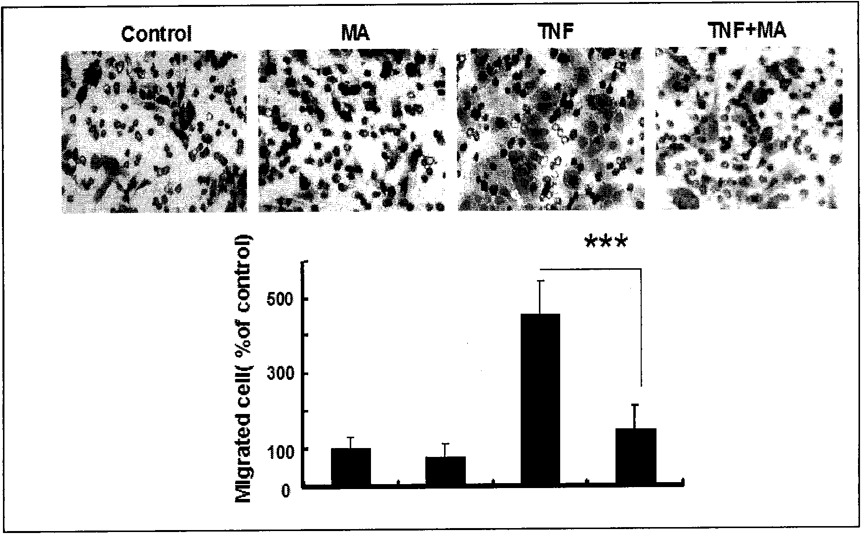 Antitumor MA-TNF alpha medicine composition and application thereof