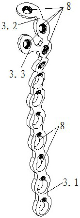 Ulna olecranon morphological anatomy locking method and steel plate structure