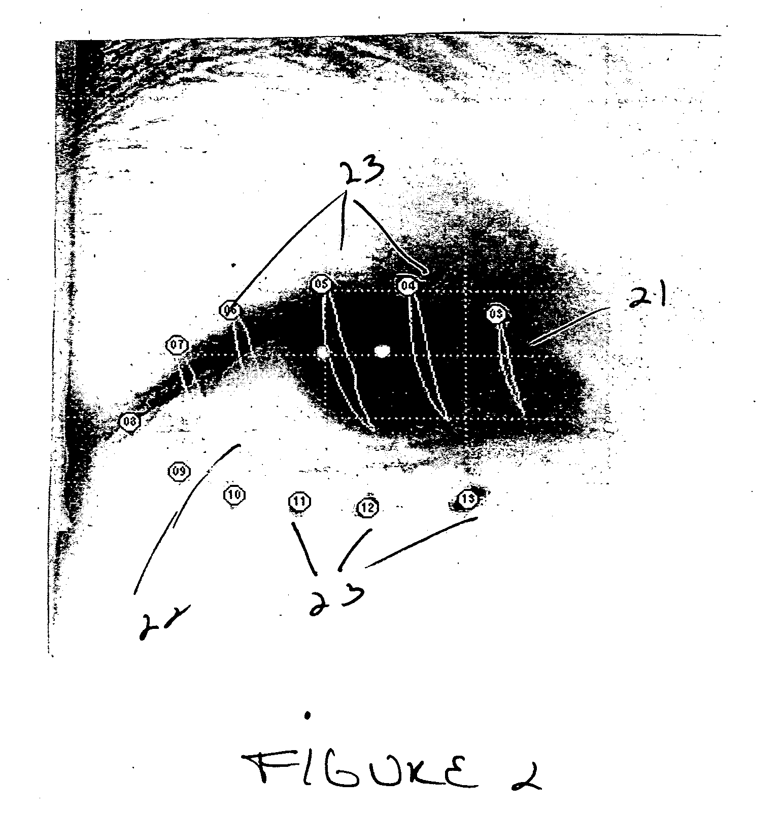 Method for evaluating eyelid movement and contact lens position