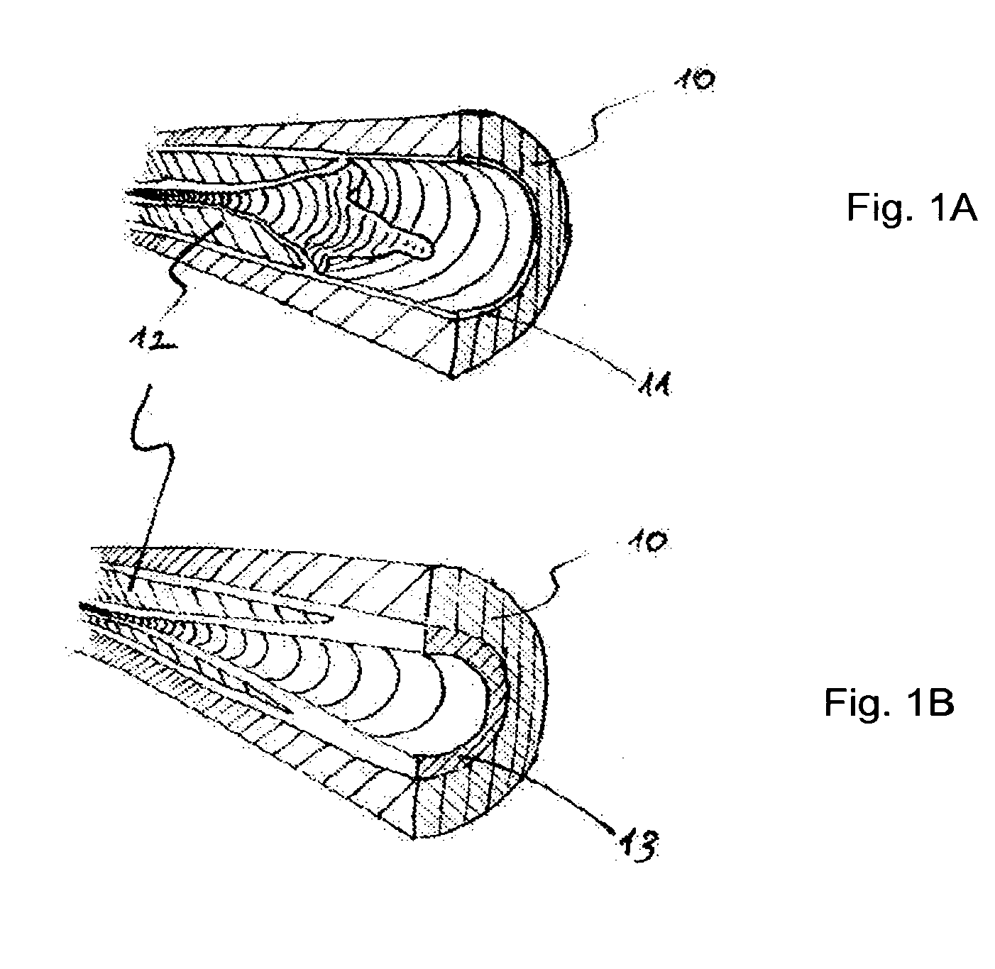 Devices and methods for percutaneous endarterectomy