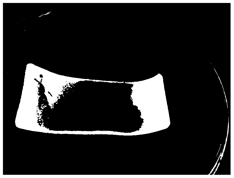 Preparation method of amnion-spongy chitosan composite double-layer wound dressing