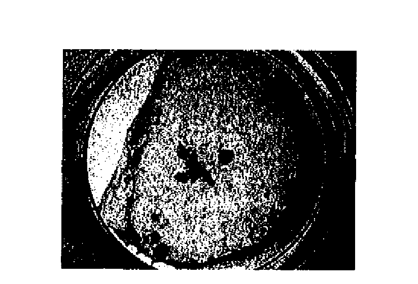 Enhancement Of The Calcium Sensing Receptor