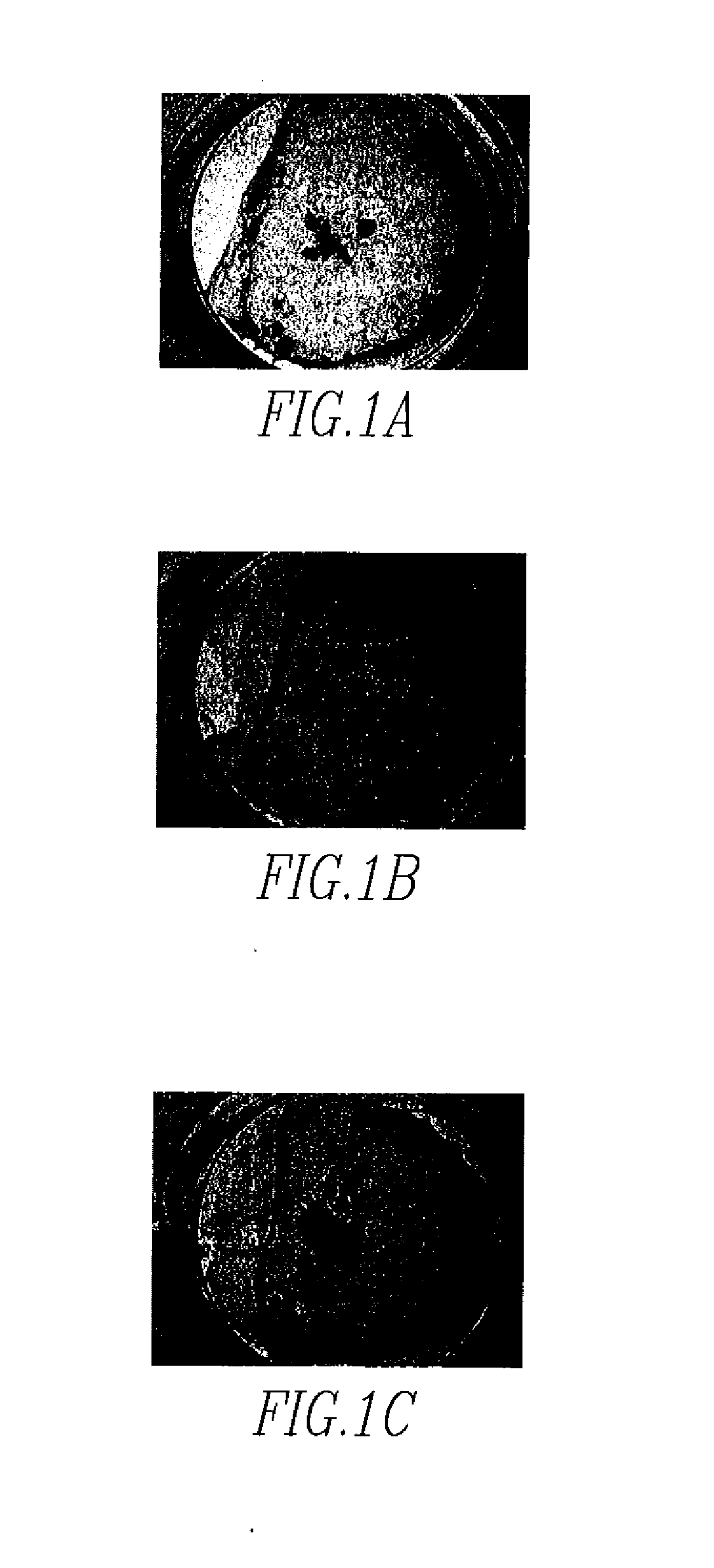 Enhancement Of The Calcium Sensing Receptor