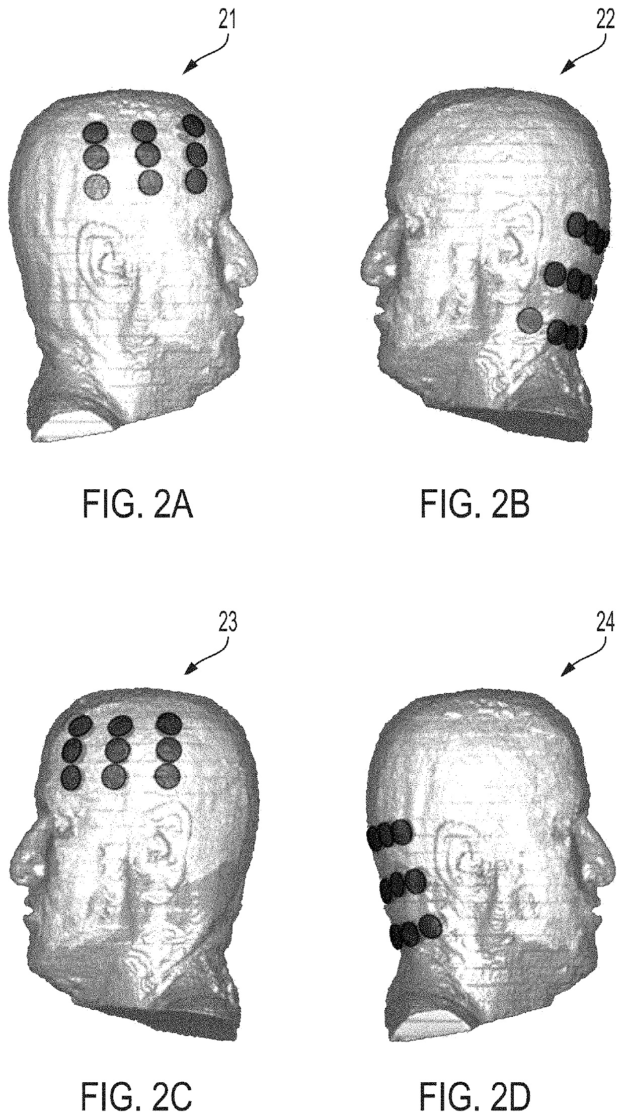 Generating Tumor Treating Fields (TTFields) with High Uniformity throughout the Brain