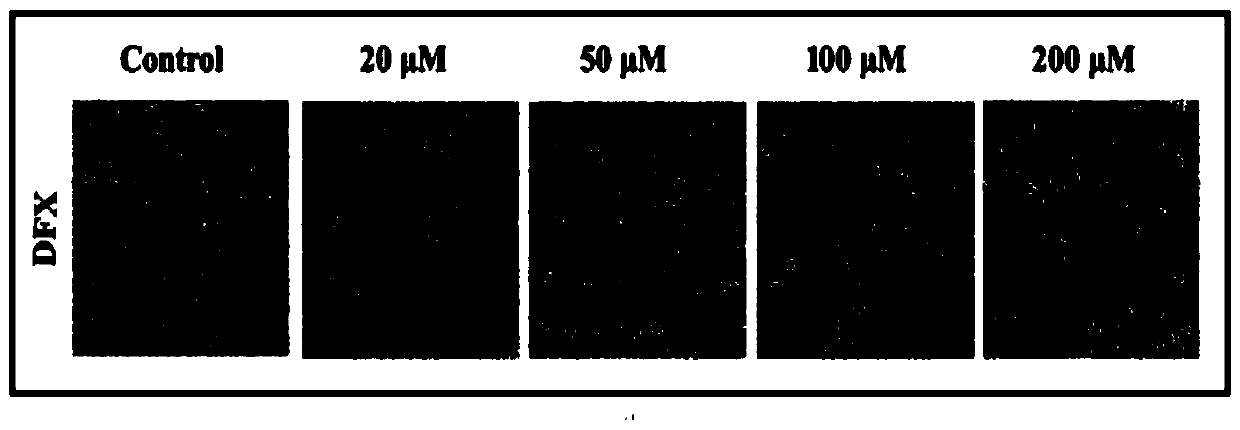 Application of iron chelator Deferasirox (DFX) in drug for treating cervical cancer