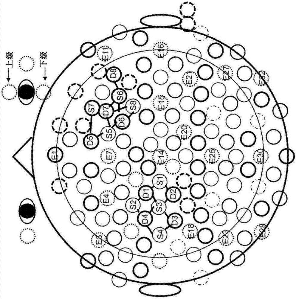 Montage design for closed loop sensing and neurostimulation of the dorsal lateral prefrontal cortex and/or motor cortex