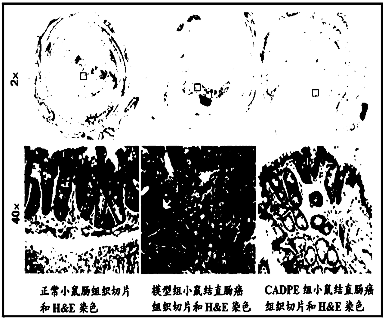 Application of caffeic acid 3,4-dyhydroxy phenethyl ester to preparing medicine for preventing colorectal cancer