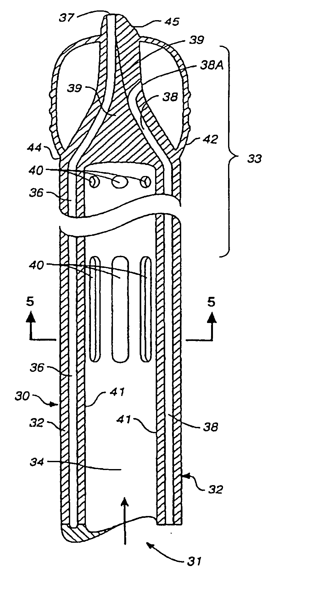 Venous cannula and cardiopulmonary bypass system