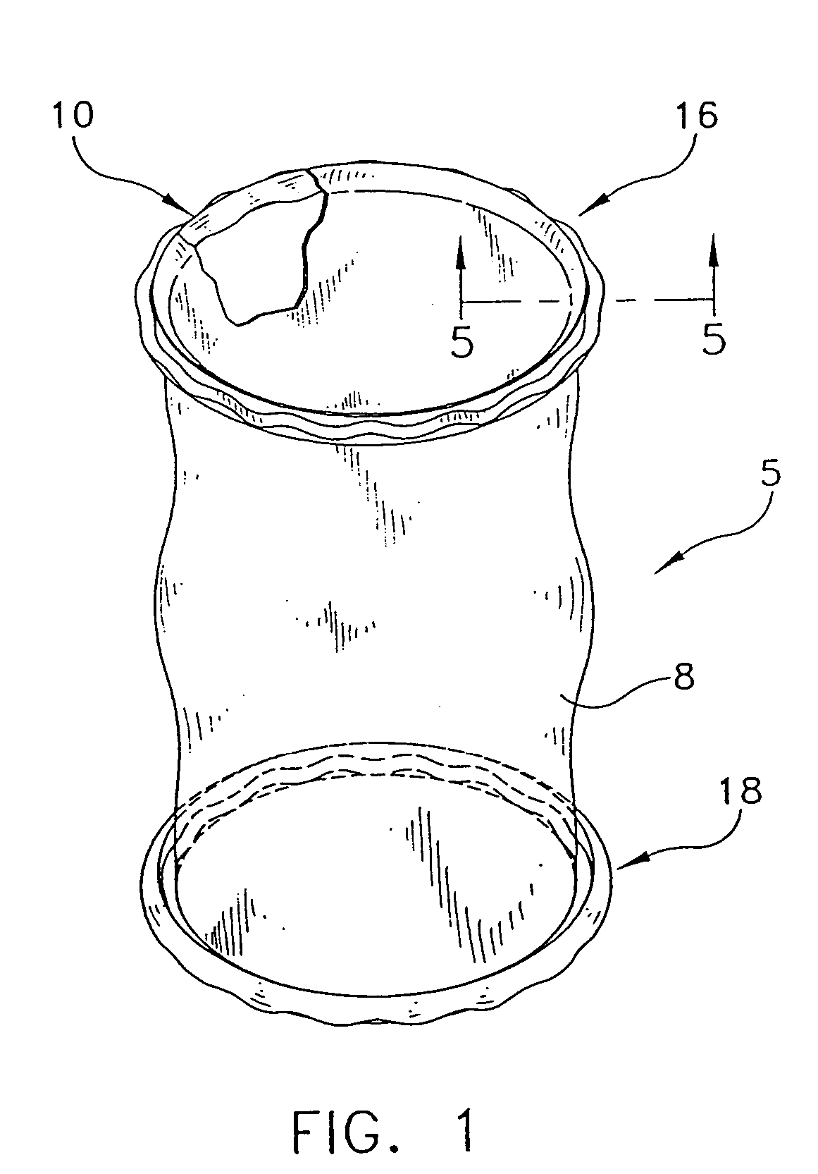 O-ring for incrementally adjustable incision liner and retractor