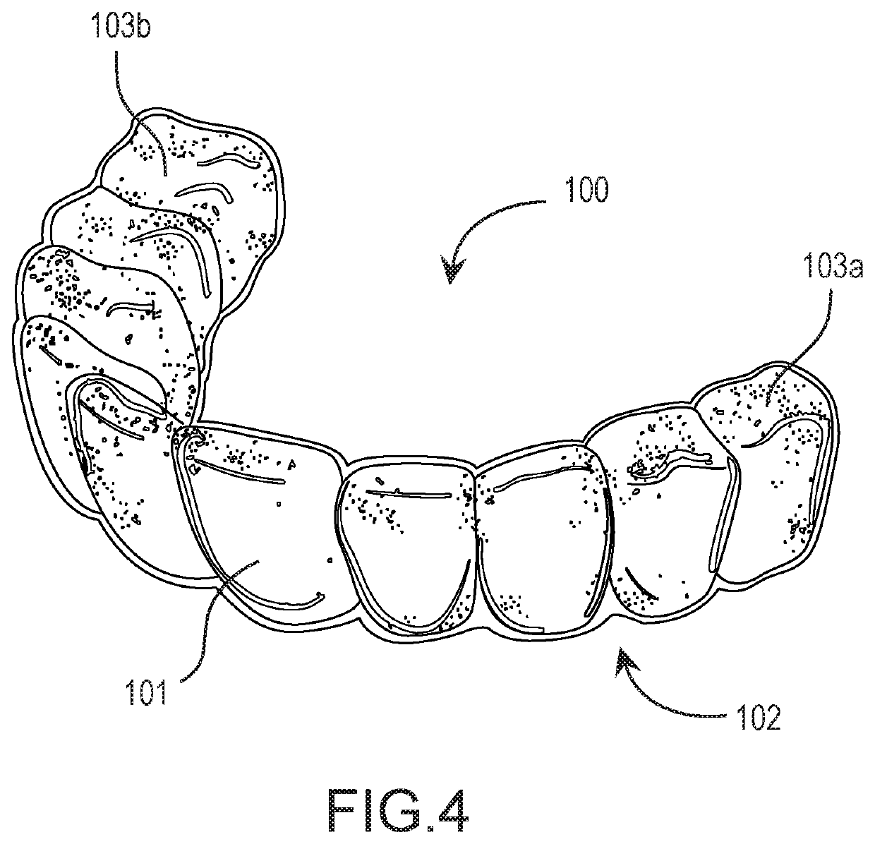 Orthotic devices & methods for treating complications of the masticatory neuromusculature