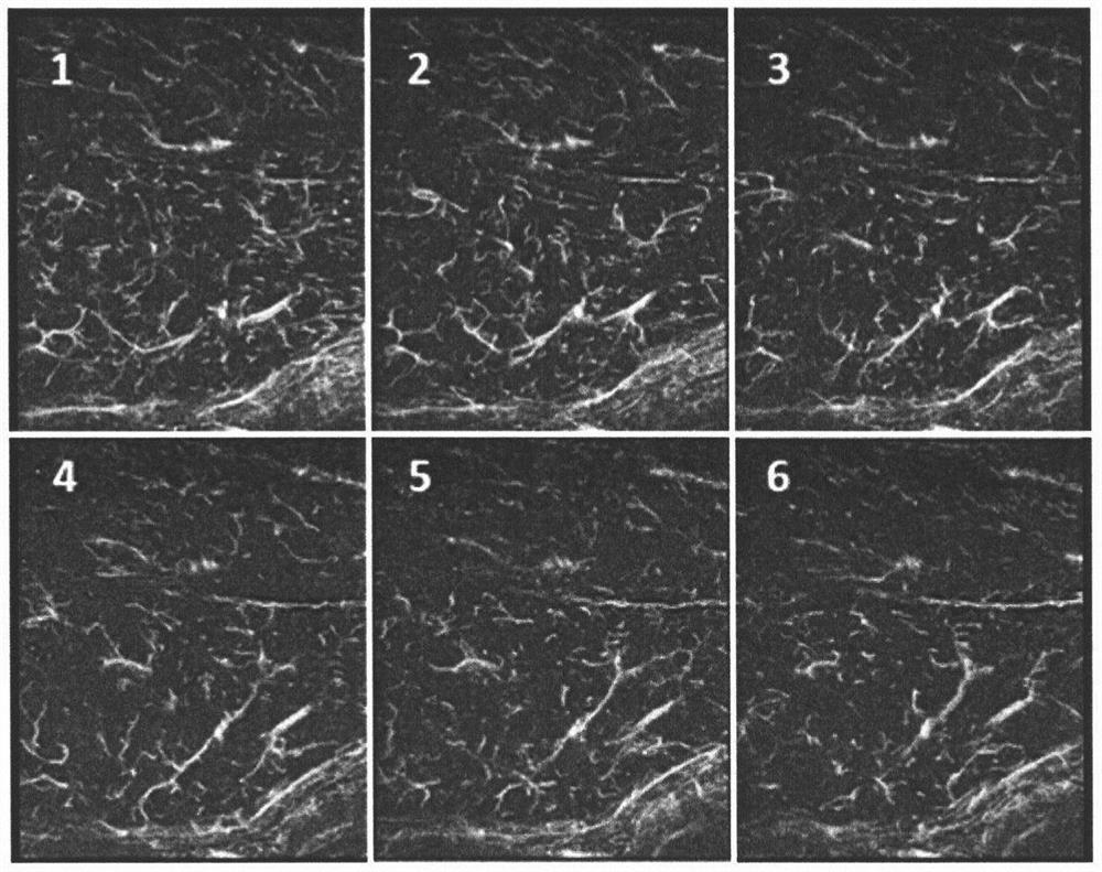 A method of ultrasonic super-resolution imaging