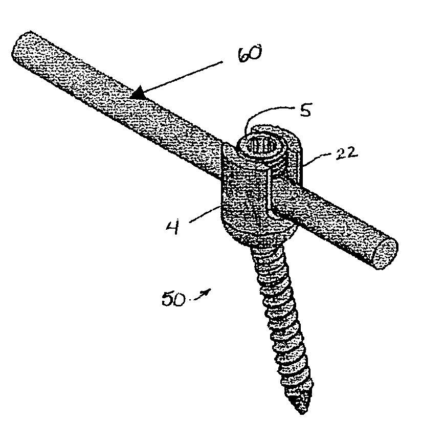 Multi-axial bone screw mechanism