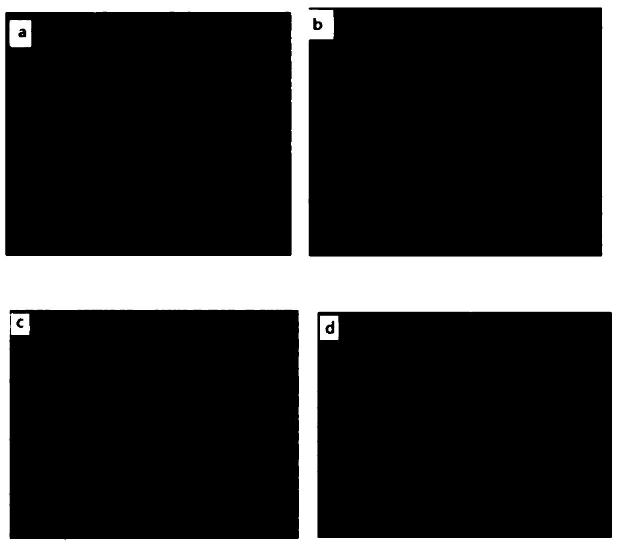 Traditional Chinese medicine composition for treatment of liver lenticular degeneration hepatic fibrosis and application